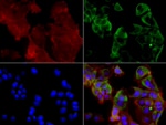 KRT19 Antibody in Immunocytochemistry (ICC/IF)