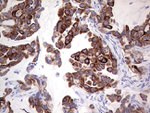 KRT19 Antibody in Immunohistochemistry (Paraffin) (IHC (P))