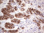 KRT19 Antibody in Immunohistochemistry (Paraffin) (IHC (P))