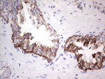 KRT19 Antibody in Immunohistochemistry (Paraffin) (IHC (P))