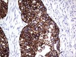 KRT19 Antibody in Immunohistochemistry (Paraffin) (IHC (P))