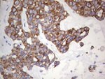 KRT19 Antibody in Immunohistochemistry (Paraffin) (IHC (P))