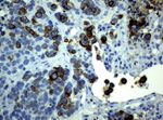 KRT19 Antibody in Immunohistochemistry (Paraffin) (IHC (P))