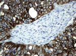 KRT19 Antibody in Immunohistochemistry (Paraffin) (IHC (P))