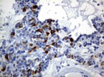 KRT19 Antibody in Immunohistochemistry (Paraffin) (IHC (P))