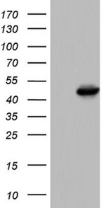 KRT19 Antibody in Western Blot (WB)