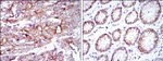 Cytokeratin 19 Antibody in Immunohistochemistry (Paraffin) (IHC (P))