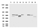 KRT20 Antibody in Western Blot (WB)