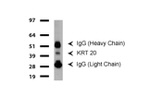 KRT20 Antibody in Western Blot (WB)