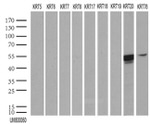 KRT20 Antibody in Western Blot (WB)