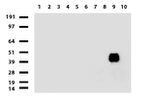 KRT20 Antibody in Western Blot (WB)