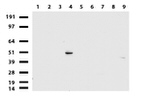 KRT20 Antibody in Western Blot (WB)