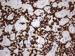 KRT24 Antibody in Immunohistochemistry (Paraffin) (IHC (P))