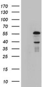 KRT24 Antibody in Western Blot (WB)