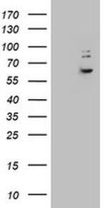 KRT24 Antibody in Western Blot (WB)