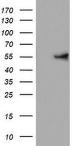 KRT24 Antibody in Western Blot (WB)