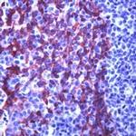 Cytokeratin 5 Antibody in Immunohistochemistry (Paraffin) (IHC (P))