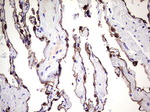 KRT7 Antibody in Immunohistochemistry (Paraffin) (IHC (P))