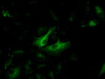 KRT8 Antibody in Immunocytochemistry (ICC/IF)