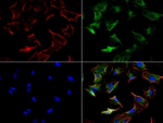 KRT8 Antibody in Immunocytochemistry (ICC/IF)