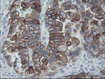 KRT8 Antibody in Immunohistochemistry (Paraffin) (IHC (P))