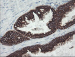 KRT8 Antibody in Immunohistochemistry (Paraffin) (IHC (P))