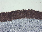 KRT8 Antibody in Immunohistochemistry (Paraffin) (IHC (P))