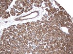 KRT8 Antibody in Immunohistochemistry (Paraffin) (IHC (P))