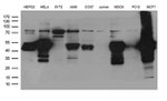 KRT8 Antibody in Western Blot (WB)