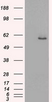 KRT8 Antibody in Western Blot (WB)