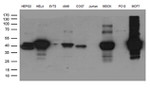 KRT8 Antibody in Western Blot (WB)