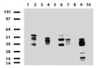 KRT8 Antibody in Western Blot (WB)