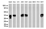 KRT8 Antibody in Western Blot (WB)