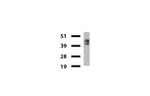 KRT8 Antibody in Western Blot (WB)