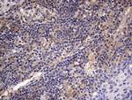 KYNU Antibody in Immunohistochemistry (Paraffin) (IHC (P))