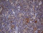 KYNU Antibody in Immunohistochemistry (Paraffin) (IHC (P))