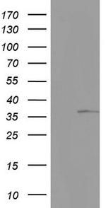 KYNU Antibody in Western Blot (WB)