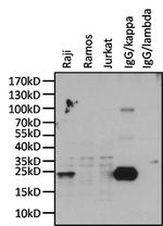 Human Kappa Light Chain Secondary Antibody in Western Blot (WB)