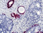 Cytokeratin 5 Antibody in Immunohistochemistry (Paraffin) (IHC (P))