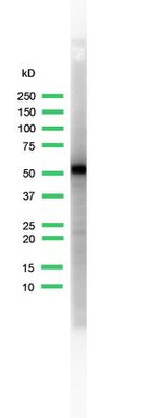 Cytokeratin 5 Antibody in Western Blot (WB)