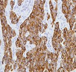 Cytokeratin 8 Antibody in Immunohistochemistry (Paraffin) (IHC (P))