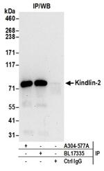 Kindlin-2 Antibody in Western Blot (WB)