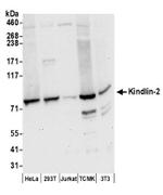 Kindlin-2 Antibody in Western Blot (WB)