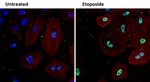 Ku70 Antibody in Immunocytochemistry (ICC/IF)