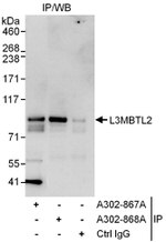 L3MBTL2 Antibody in Immunoprecipitation (IP)