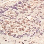 L3MBTL3 Antibody in Immunohistochemistry (IHC)