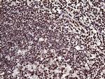 L3MBTL3 Antibody in Immunohistochemistry (Paraffin) (IHC (P))