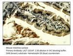 Lactase (LCT) Antibody in Immunohistochemistry (IHC)