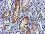 LACTB2 Antibody in Immunohistochemistry (Paraffin) (IHC (P))