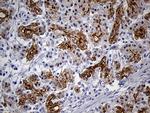 LAD1 Antibody in Immunohistochemistry (Paraffin) (IHC (P))